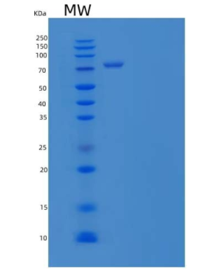 Recombinant Human Kelch-Like protein 41/Kell/CD238 Protein(C-6His),Recombinant Human Kelch-Like protein 41/Kell/CD238 Protein(C-6His)