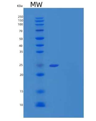 Recombinant Human Interleukin-22 receptor subunit alpha-2/Interleukin-22 Binding Protein,Recombinant Human Interleukin-22 receptor subunit alpha-2/Interleukin-22 Binding Protein