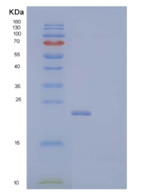 Recombinant Mouse Thymic Stromal Lymphopoietin Receptor/TSP R Protein(C-6His),Recombinant Mouse Thymic Stromal Lymphopoietin Receptor/TSP R Protein(C-6His)