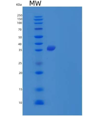 Recombinant Human α-N-Acetylneuraminide α-2,8-Sialyltransferase/ST8SIA1 Protein(C-6His),Recombinant Human α-N-Acetylneuraminide α-2,8-Sialyltransferase/ST8SIA1 Protein(C-6His)