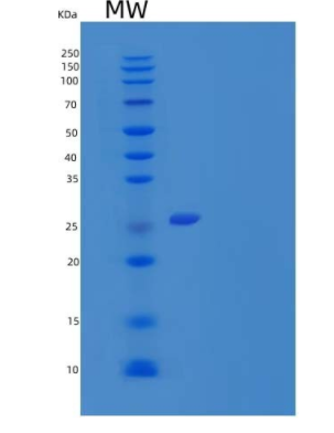 Recombinant Mouse TNF ligand superfamily member 9/TNFSF9 Protein(N-10His),Recombinant Mouse TNF ligand superfamily member 9/TNFSF9 Protein(N-10His)