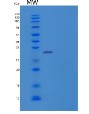 Recombinant Human β-1,3-Glucuronyltransferase 3/B3GAT3 Protein(C-6His),Recombinant Human β-1,3-Glucuronyltransferase 3/B3GAT3 Protein(C-6His)