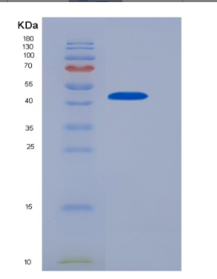 Recombinant Human CD32a / FCGR2A Protein (167 Arg, Fc tag),Recombinant Human CD32a / FCGR2A Protein (167 Arg, Fc tag)