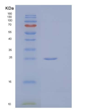 Recombinant Human Butyrophilin 1A1/BTN1A1 Protein(C-6His),Recombinant Human Butyrophilin 1A1/BTN1A1 Protein(C-6His)