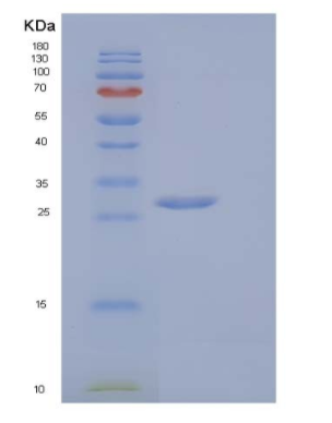 Recombinant Mouse V-Set and Ig Domain-Containing Protein 8/VSIG8 Protein(C-6His),Recombinant Mouse V-Set and Ig Domain-Containing Protein 8/VSIG8 Protein(C-6His)