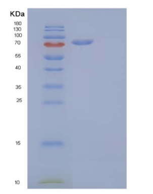 Recombinant Human Cadherin-16/CDH16 Protein(C-6His),Recombinant Human Cadherin-16/CDH16 Protein(C-6His)