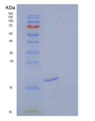 Recombinant Human Fibroblast Growth Factor 1/FGF-1/FGFa(Ala2-Asp155) Protein,Recombinant Human Fibroblast Growth Factor 1/FGF-1/FGFa(Ala2-Asp155) Protein