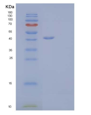 Recombinant Human Lymphotactin/LTN/XCL1 Protein(C-Fc-6His),Recombinant Human Lymphotactin/LTN/XCL1 Protein(C-Fc-6His)