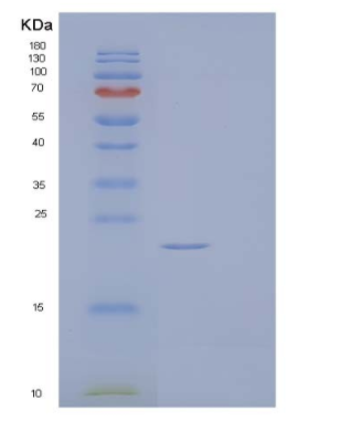 Recombinant Human Fibroblast Growth Factor 17/FGF-17 Protein(C-6His),Recombinant Human Fibroblast Growth Factor 17/FGF-17 Protein(C-6His)