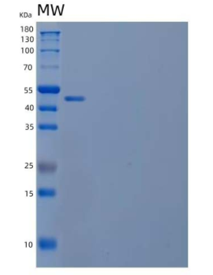 Recombinant Human Calnexin/CANX Protein(C-6His),Recombinant Human Calnexin/CANX Protein(C-6His)