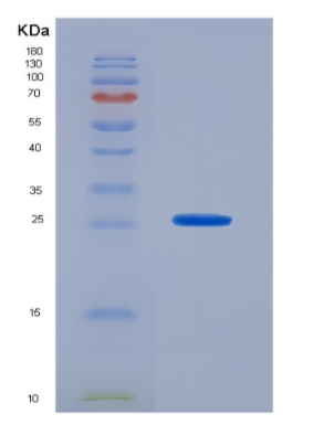 Recombinant Prion Protein (PRNP),Recombinant Prion Protein (PRNP)