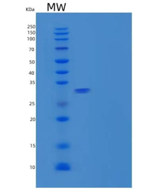 Recombinant Human Carbonic Anhydrase 10/CA10 Protein(N-6His),Recombinant Human Carbonic Anhydrase 10/CA10 Protein(N-6His)