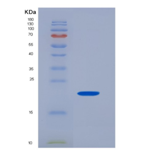 Recombinant Human CD32a / FCGR2A Protein (166 Arg, His tag)
