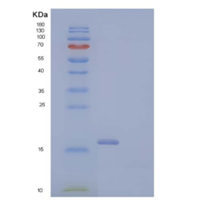 Recombinant Human Zymogen Granule Membrane Protein 16/ZG16 Protein(C-6His),Recombinant Human Zymogen Granule Membrane Protein 16/ZG16 Protein(C-6His)