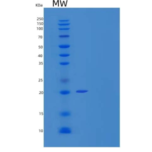 Recombinant Human α B Crystallin Chain/CRYAB Protein(C-6His)