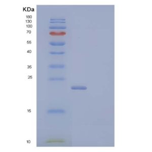 Recombinant Mouse Thymic Stromal Lymphopoietin Receptor/TSP R Protein(C-6His),Recombinant Mouse Thymic Stromal Lymphopoietin Receptor/TSP R Protein(C-6His)