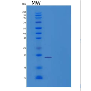 Recombinant Human Protein Kinase C Type ε/PKC ε/PKCE Protein(C-6His)
