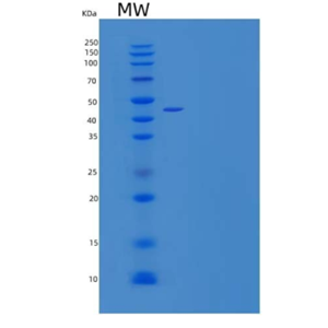 Recombinant Human B3GNT1 Protein(C-6His)
