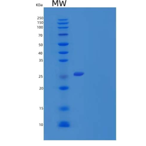 Recombinant Mouse TNF ligand superfamily member 9/TNFSF9 Protein(N-10His),Recombinant Mouse TNF ligand superfamily member 9/TNFSF9 Protein(N-10His)