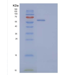 Recombinant Human Leucine-Rich α-2-Glycoprotein/LRG1 Protein(C-Fc-6His)