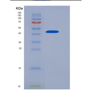 Recombinant Human CD32a / FCGR2A Protein (167 Arg, Fc tag)