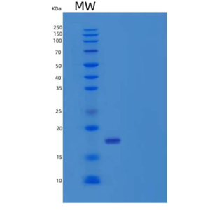 Recombinant Human Leukocyte Mono Ig-Like Receptor 2/LMIR2/CD300C Protein(C-6His)