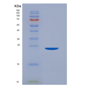 Recombinant Human CD32a / FCGR2A Protein (167 Arg, His & AVI tag)