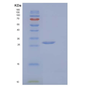 Recombinant Mouse V-Set and Ig Domain-Containing Protein 8/VSIG8 Protein(C-6His)
