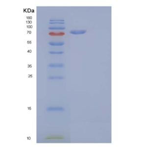 Recombinant Human Cadherin-16/CDH16 Protein(C-6His)
