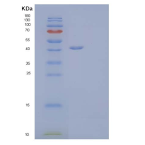 Recombinant Human Lymphotactin/LTN/XCL1 Protein(C-Fc-6His)