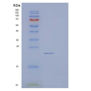 Recombinant Human Fibroblast Growth Factor 17/FGF-17 Protein(C-6His)