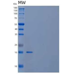 Recombinant Human Lysozyme C/LYZ Protein(C-6His)