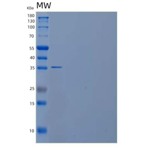 Recombinant Human Ribose-Phosphate Pyrophosphokinase 2/PRPS2 Protein(C-6His)