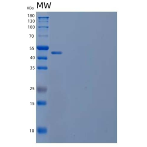 Recombinant Human Calnexin/CANX Protein(C-6His)