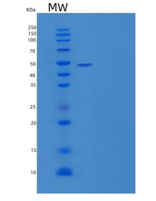 Recombinant Human Serpin A10/ZPI Protein(C-6His),Recombinant Human Serpin A10/ZPI Protein(C-6His)