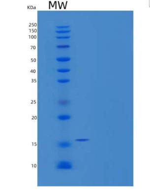 Recombinant Human Microtubule-Associated Protein Tau/MAPT-D/Tau-D Protein(C-6His),Recombinant Human Microtubule-Associated Protein Tau/MAPT-D/Tau-D Protein(C-6His)