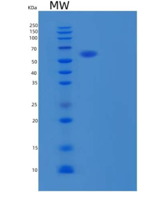 Recombinant Human GALNTL1 Protein(C-6His),Recombinant Human GALNTL1 Protein(C-6His)