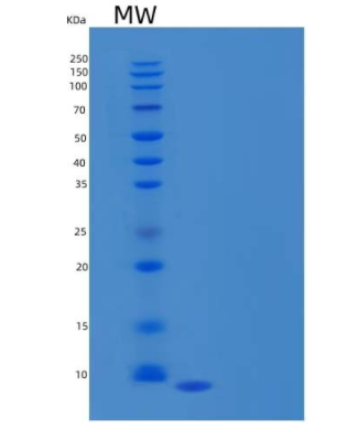 Recombinant Human C-C Motif Chemokine 3-Like 1/CCL3L1 Protein(C-6His),Recombinant Human C-C Motif Chemokine 3-Like 1/CCL3L1 Protein(C-6His)