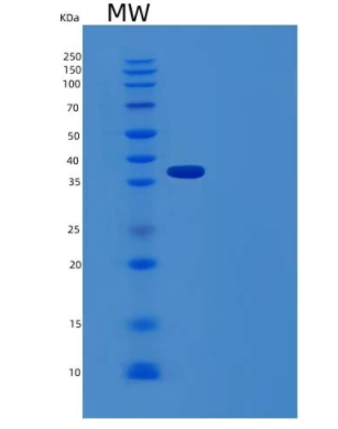 Recombinant Human N-Acyl-Aromatic-L-Amino Acid Amidohydrolase/ACY3 Protein(N-6His),Recombinant Human N-Acyl-Aromatic-L-Amino Acid Amidohydrolase/ACY3 Protein(N-6His)