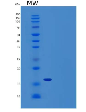 Recombinant Human Natural Killer Cells Antigen CD94/CD94 Protein(N-6His),Recombinant Human Natural Killer Cells Antigen CD94/CD94 Protein(N-6His)