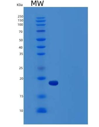 Recombinant Rat Vascular Endothelial Growth Factor A Protein,Recombinant Rat Vascular Endothelial Growth Factor A Protein