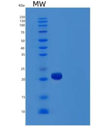 Recombinant Human VEGFC Protein,Recombinant Human VEGFC Protein