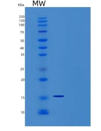 Recombinant Human Interleukin-4/IL-4 Protein,Recombinant Human Interleukin-4/IL-4 Protein