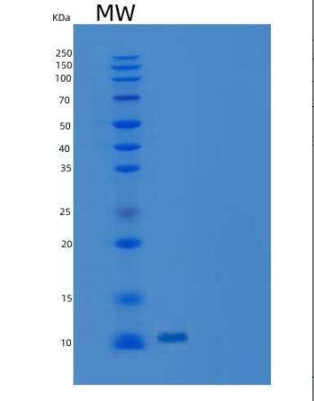 Recombinant Human C-C Motif Chemokine 16/CCL16 Protein,Recombinant Human C-C Motif Chemokine 16/CCL16 Protein