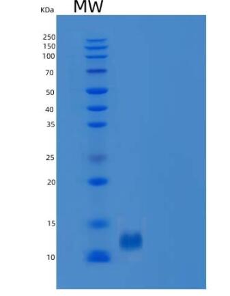 Recombinant Human B2M / Beta-2-microglobulin Protein (His tag),Recombinant Human B2M / Beta-2-microglobulin Protein (His tag)