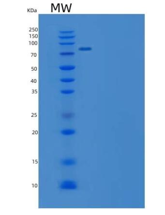 Recombinant Mouse EphB4 / HTK Protein (Fc tag)(Fc tag),Recombinant Mouse EphB4 / HTK Protein (Fc tag)(Fc tag)