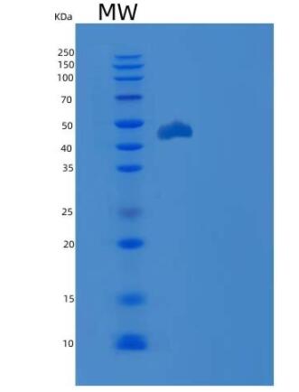 Recombinant Human CDKN2D / p19ink4d Protein (GST tag),Recombinant Human CDKN2D / p19ink4d Protein (GST tag)