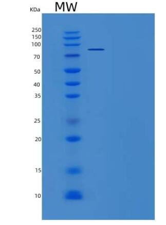 Recombinant Mouse Smad3 Protein (His & GST tag),Recombinant Mouse Smad3 Protein (His & GST tag)