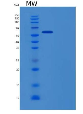 Recombinant Human EphB6 / EphB6 Protein (His tag),Recombinant Human EphB6 / EphB6 Protein (His tag)