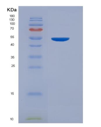 Eukaryotic Osteoprotegerin (OPG),Eukaryotic Osteoprotegerin (OPG)